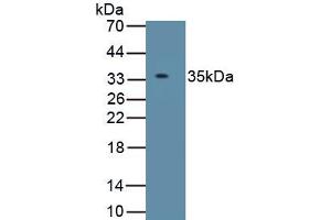 Detection of Recombinant IGFBP2, Bovine using Polyclonal Antibody to Insulin Like Growth Factor Binding Protein 2 (IGFBP2)