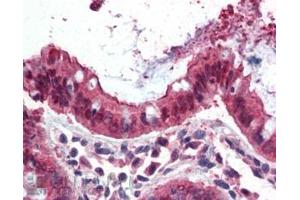 ABIN185664 (3. (Ezrin 抗体  (Internal Region))