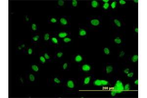 Immunofluorescence of monoclonal antibody to GATA2 on HeLa cell. (GATA2 抗体  (AA 1-102))