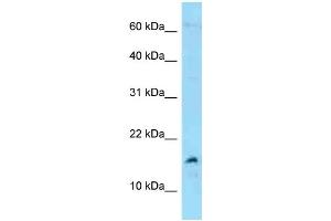 WB Suggested Anti-MDK Antibody Titration: 1. (Midkine 抗体  (C-Term))