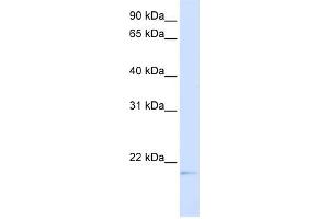 WB Suggested Anti-C14orf180 Antibody Titration:  0. (C14orf180 抗体  (Middle Region))