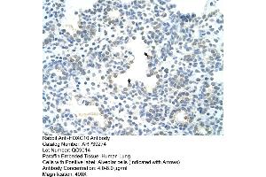Human Lung (HOXC10 抗体  (N-Term))