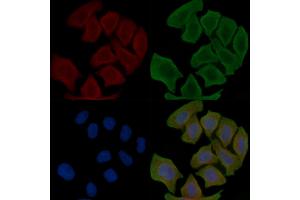 ABIN6266215 and ABIN6277373 staining Hela cells(30 min of UV treatment) by IF/ICC.