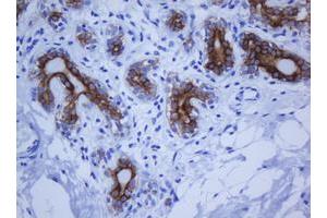 Image no. 3 for anti-Keratin 20 (KRT20) (AA 1-266) antibody (ABIN1490690)