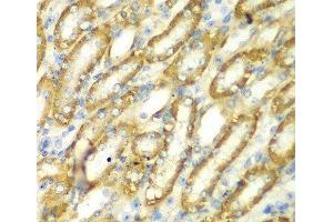 Immunohistochemistry of paraffin-embedded Mouse kidney using TM9SF1 Polyclonal Antibody at dilution of 1:100 (40x lens). (TM9SF1 抗体)