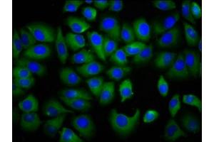 Immunofluorescence staining of A549 cells with ABIN7157022 at 1:166, counter-stained with DAPI. (IYD 抗体  (AA 24-147))