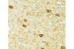 Immunohistochemistry of paraffin-embedded Mouse brain using PVALB Polyclonal Antibody at dilution of 1:100 (40x lens). (PVALB 抗体)