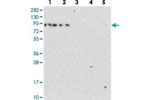 Western blot analysis of Lane 1: RT-4, Lane 2: U-251 MG, Lane 3: Human Plasma, Lane 4: Liver, Lane 5: Tonsil with DDX51 polyclonal antibody  at 1:250-1:500 dilution. (DDX51 抗体)