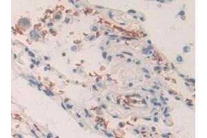 Immunohistochemistry (IHC) image for anti-Solute Carrier Family 4, Anion Exchanger, Member 1 (erythrocyte Membrane Protein Band 3, Diego Blood Group) (SLC4A1) (AA 35-290) antibody (ABIN7441895)