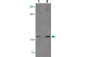 Western blot analysis of CISD2 in rat brain tissue with CISD2 polyclonal antibody  at (lane 1) 1 and (lane 2) 2 µg/m.