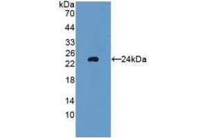 Western blot analysis of recombinant Rat GPX5. (GPX5 抗体  (AA 22-221))