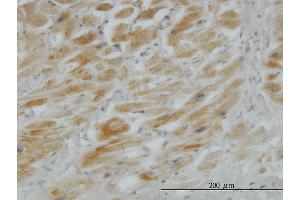 Immunoperoxidase of monoclonal antibody to HHIP on formalin-fixed paraffin-embedded human heart. (HHIP 抗体  (AA 21-120))