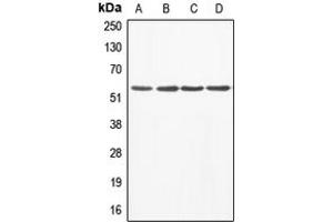 Western blot analysis of ABI1 expression in A549 (A), MCF7 (B), mouse liver (C), rat heart (D) whole cell lysates. (ABI1 抗体  (Center))