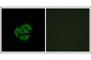 Immunofluorescence analysis of A549 cells, using CYP39A1 Antibody . (CYP39A1 抗体  (C-Term))