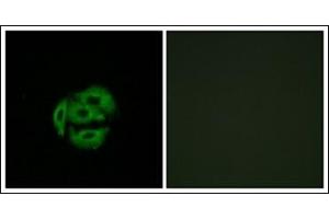 Immunofluorescence (IF) image for anti-Cytochrome P450, Family 39, Subfamily A, Polypeptide 1 (CYP39A1) (C-Term) antibody (ABIN951785)