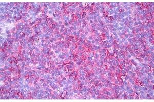 Anti-HLA-DR antibody IHC staining of human thymus, medulla. (HLA-DR 抗体)