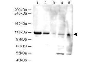 Image no. 1 for anti-ATPase Family, AAA Domain Containing 5 (ATAD5) (AA 63-76) antibody (ABIN401276) (ATAD5 抗体  (AA 63-76))