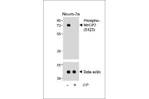 Western blot analysis of lysates from Neuro-2a cell line, untreated or treated with calf intestinal alkaline phosphatase(CIP), using Phospho-MeCP2 Antibody (upper) or Beta-actin (lower). (MECP2 抗体  (pSer423))