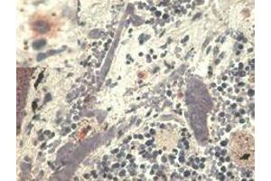 Immunohistochemistry staining with anti-human HLA-G (MEM-G/1). (HLAG 抗体  (Biotin))