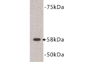 Western Blotting (WB) image for anti-Deoxynucleotidyltransferase, terminal (DNTT) (C-Term) antibody (ABIN1854983) (TdT 抗体  (C-Term))