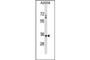Western blot analysis of SPEM1 Antibody (Center) in A2058 cell line lysates (35ug/lane). (SPEM1 抗体  (Middle Region))