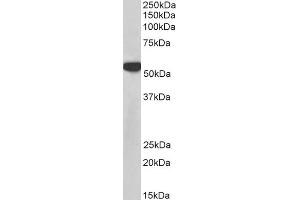 Western Blotting (WB) image for anti-Polypyrimidine Tract Binding Protein 1 (PTBP1) (N-Term) antibody (ABIN185079)