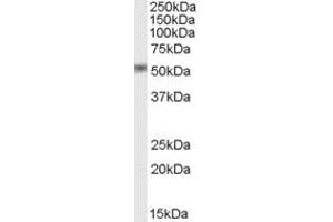 Western Blotting (WB) image for anti-STEAP Family Member 4 (STEAP4) (AA 441-456) antibody (ABIN297718) (STEAP4 抗体  (AA 441-456))