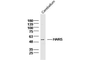 Mouse cerebellum lysates probed with HARS Polyclonal Antibody, Unconjugated  at 1:300 dilution and 4˚C overnight incubation. (HARS1/Jo-1 抗体  (AA 21-120))