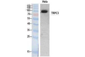 Western Blotting (WB) image for anti-Transient Receptor Potential Cation Channel, Subfamily C, Member 3 (TRPC3) (Internal Region) antibody (ABIN6283972)