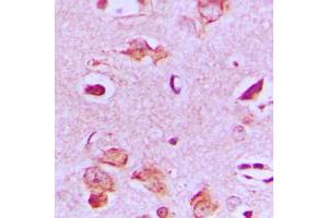 Immunohistochemical analysis of MAST4 staining in human brain formalin fixed paraffin embedded tissue section. (MAST4 抗体  (N-Term))