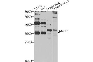 Western blot analysis of extracts of various cell lines, using MCL1 antibody (ABIN5970080) at 1/1000 dilution. (MCL-1 抗体  (C-Term))
