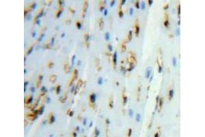 Used in DAB staining on fromalin fixed paraffin-embedded Heart tissue (UGCGL2 抗体  (AA 1221-1408))