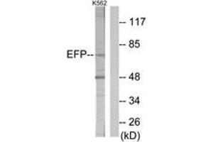 Western blot analysis of extracts from K562 cells, using ZNF147 Antibody. (TRIM25 抗体  (AA 201-250))
