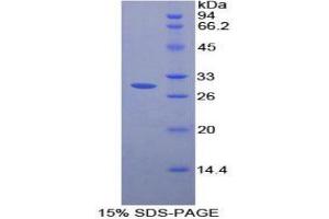 SDS-PAGE (SDS) image for Fc gamma RII (CD32) (AA 47-285) protein (His tag,T7 tag) (ABIN2126630)