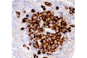 IHC analysis of CD82 using anti-CD82 antibody (ABIN3043486). (CD82 抗体  (AA 98-267))