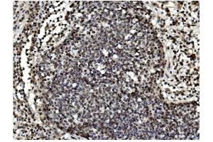 IHC analysis of TET1 using anti TET1 antibody (ABIN7600442). (TET1 抗体  (AA 194-417))