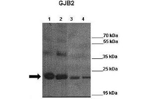 WB Suggested Anti-GJB2 Antibody    Positive Control:  Lane 1: 4ug mCx26 elution fraction 6  Lane 2: 4ug mCx26 elution fraction 7 Lane 3: 4ug mCx26 elution fraction 6 + other Cx26 antibody  Lane 4: 4ug mCx26 elution fraction 7 + other Cx26 antibody   Primary Antibody Dilution :   1:3000  Secondary Antibody :  Anti-rabbit-HRP   Secondry Antibody Dilution :   1:3000  Submitted by:  Juan Zou, Georgia state unviersity