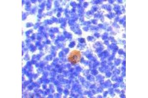 Immunohistochemistry of CARMA1 in mouse thymus with CARMA1 antibody at 10 μg/ml. (CARD11 抗体)