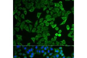Immunofluorescence analysis of HeLa cells using NPRL2 Polyclonal Antibody (NPRL2 抗体)