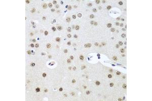 Immunohistochemistry of paraffin-embedded mouse brain using UTP14A antibody at dilution of 1:100 (40x lens). (UTP14A 抗体)