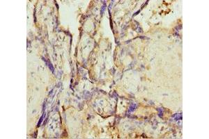 Immunohistochemistry of paraffin-embedded human placenta tissue using ABIN7173219 at dilution of 1:100 (TMEM43 抗体  (AA 80-310))