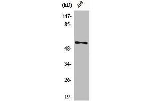 Western Blot analysis of 293 cells using Phospho-Synaptotagmin 1/2 (S309/306) Polyclonal Antibody (SYT1/SYT2 (pSer306), (pSer309) 抗体)