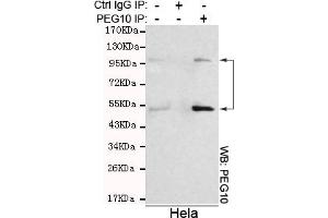 Immunoprecipitation analysis of Hela cell lysates using PEG10 mouse mAb. (PEG10 抗体)
