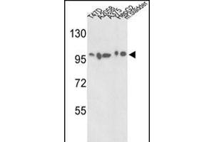 Western blot analysis of ACTN4 Antibody (C-term) (ABIN392219 and ABIN2841915) in T47D, , , HepG2 cell line and mouse bladder tissue lysates (35 μg/lane). (alpha Actinin 4 抗体  (C-Term))
