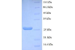 SDS-PAGE (SDS) image for Neuritin 1 (NRN1) (AA 28-116) protein (His-SUMO Tag) (ABIN5711807)