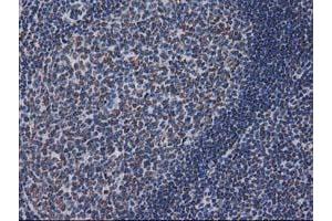 Image no. 8 for anti-CTD (Carboxy-terminal Domain, RNA Polymerase II, Polypeptide A) Small Phosphatase 1 (CTDSP1) antibody (ABIN1497679) (CTDSP1 抗体)