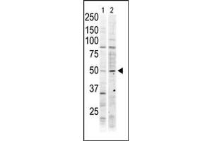 The anti-MST2 Pab (ABIN6243888 and ABIN6579022) is used in Western blot to detect MST2 in Jurkat cell lysate (lane 1) and mouse ovary tissue lysate (lane 2).