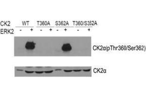 Western blot of CK2α(Phospho-Thr360/Ser362) antibody and CK2αantibody in vitro kinase assay. (CSNK2A1/CK II alpha 抗体  (AA 353-357))