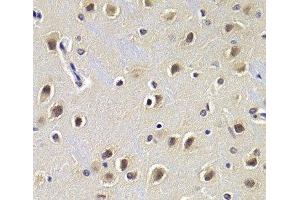 Immunohistochemistry of paraffin-embedded Rat brain using CDKN1B Polyclonal Antibody at dilution of 1:200 (40x lens). (CDKN1B 抗体)