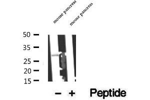 Western blot analysis of extracts of mouse pancreas tissue, using C14orf166 antibody. (C14orf166 抗体)